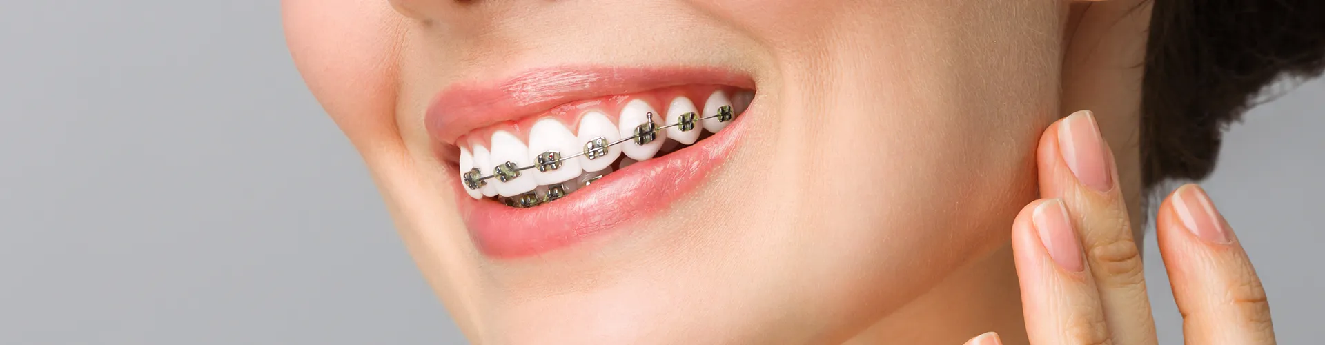 smiling woman wearing dental braces