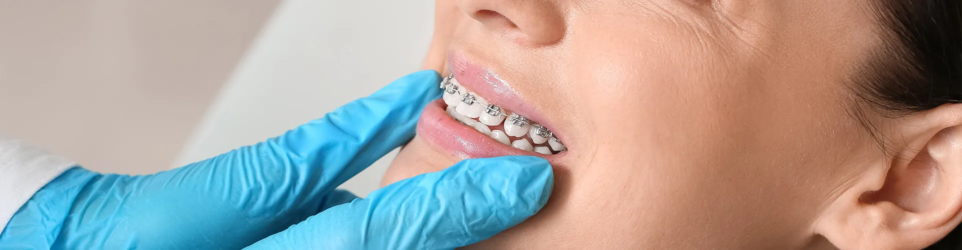 dentist holding the chin of woman wearing metal teeth braces